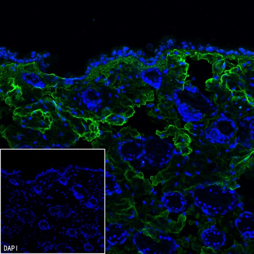 COL1A1 Recombinant Rabbit mAb (S-2975-9)
