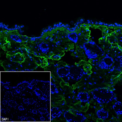 COL1A1 Recombinant Rabbit mAb (S-2975-9)