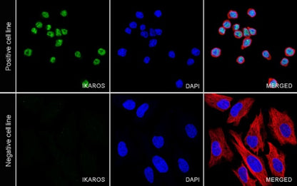 IKAROS Recombinant Rabbit mAb (S-729-146)