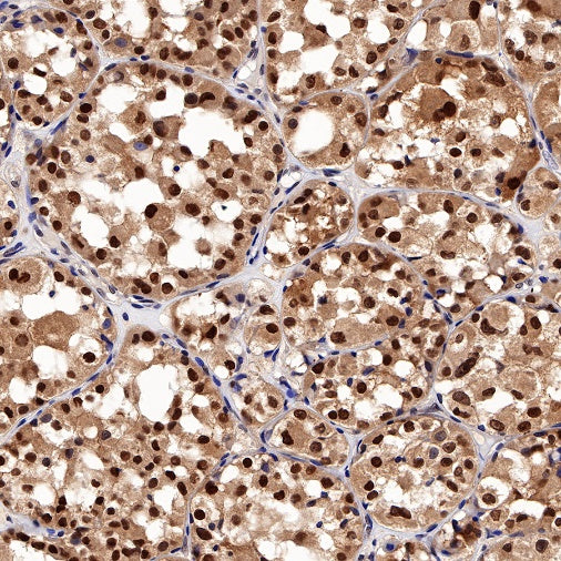 TFE3 Recombinant Rabbit mAb (SDT-760-34)