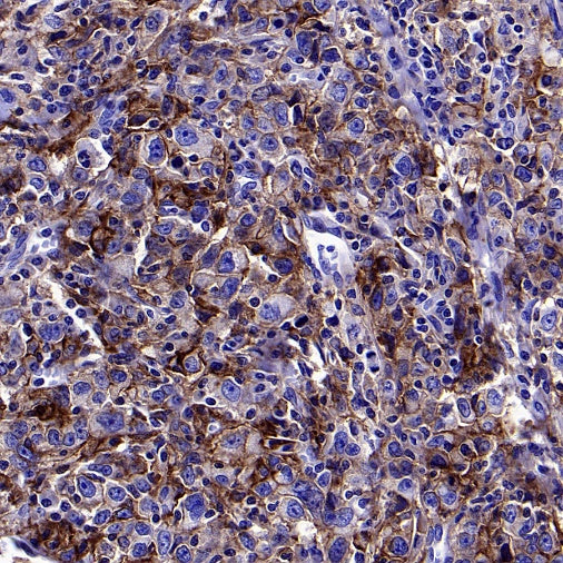 CMTM6 Recombinant Rabbit mAb (S-2013-4)