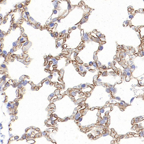 CD36 Recombinant Rabbit mAb (S-1028-127)