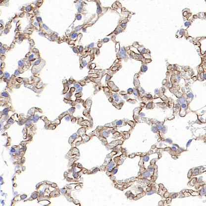 CD36 Recombinant Rabbit mAb (S-1028-127)