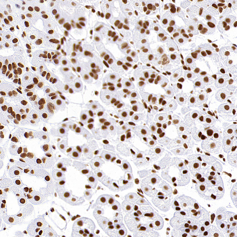 Rad21 Recombinant Rabbit mAb (S-M0006)