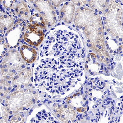 LOX Recombinant Rabbit mAb (S-1647-49)