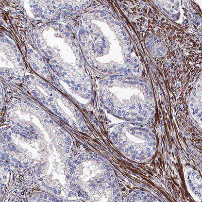 Beta Actin Recombinant Mouse mAb (S-5033)
