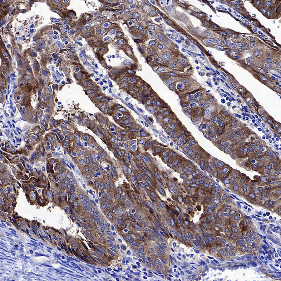 Transferrin Receptor Recombinant Rabbit mAb (S-4791)