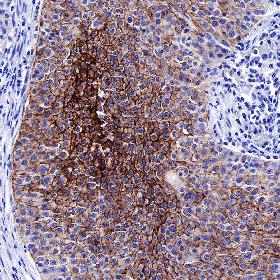 S-RMab® GLUT1 Recombinant Rabbit mAb (SDT-047-53)