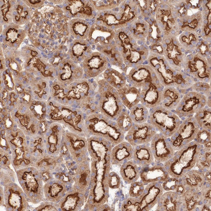 Clathrin heavy chain Recombinant Rabbit mAb (S-1690-25)