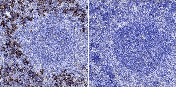 Phospho-IκBα (Ser32/36) Recombinant Rabbit mAb (S-R362)