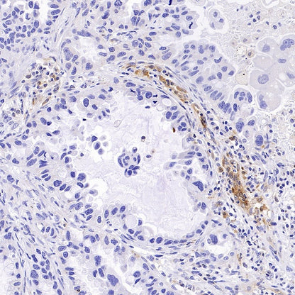 GBP5 Rabbit Polyclonal Antibody