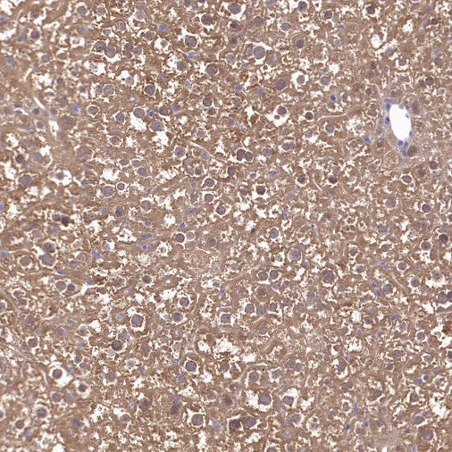 GCLM Recombinant Rabbit mAb (S-2209-19)
