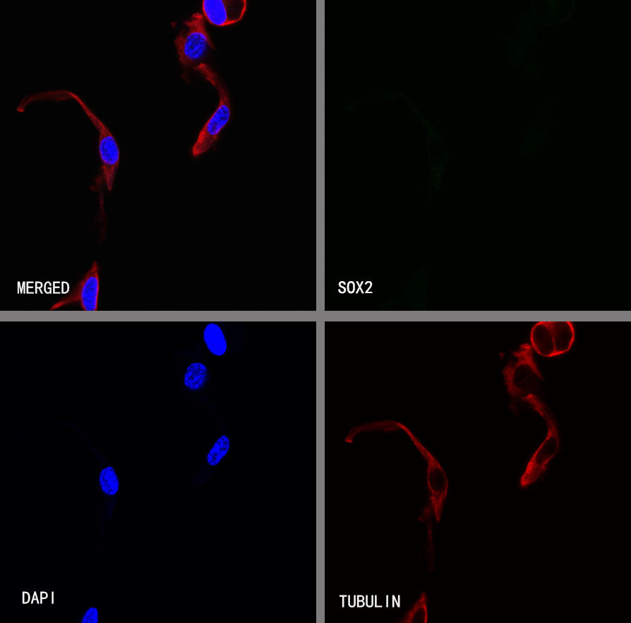 SOX2 Recombinant Rabbit mAb (S-5000)