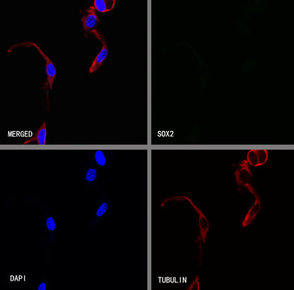 SOX2 Recombinant Rabbit mAb (S-5000)