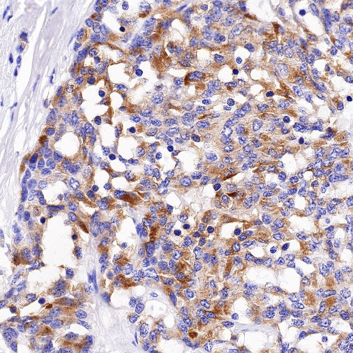 DLL3 Recombinant Rabbit mAb (S-207-179)
