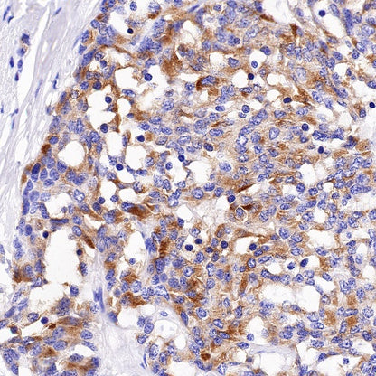 DLL3 Recombinant Rabbit mAb (S-207-179)