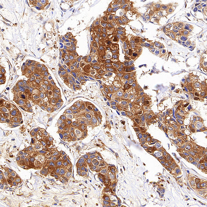 CYP1B1 Recombinant Rabbit mAb (S-6022)