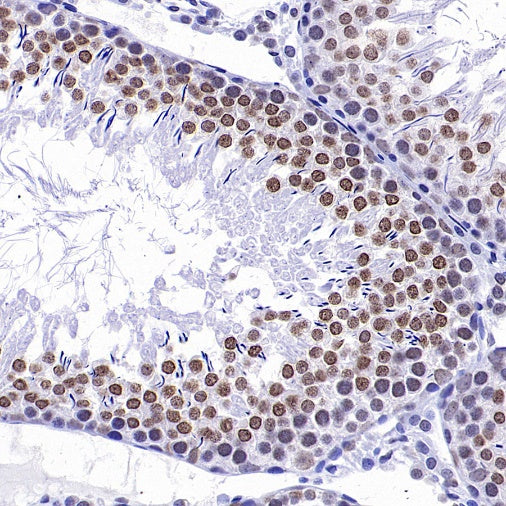 Goat Anti-Rat IgG(H+L) (HRP Conjugate)
