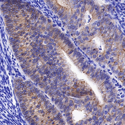 E-Cadherin Recombinant Rabbit mAb (SDT-438-45)