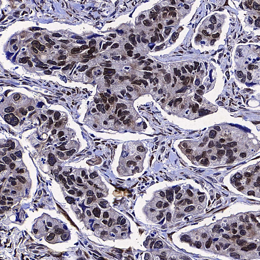 eIF6 Recombinant Rabbit mAb (S-4171-13)