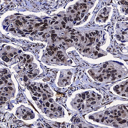 eIF6 Recombinant Rabbit mAb (S-4171-13)