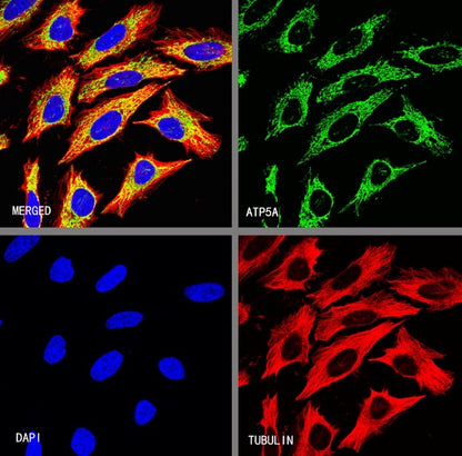ATP5A Rabbit Polyclonal Antibody