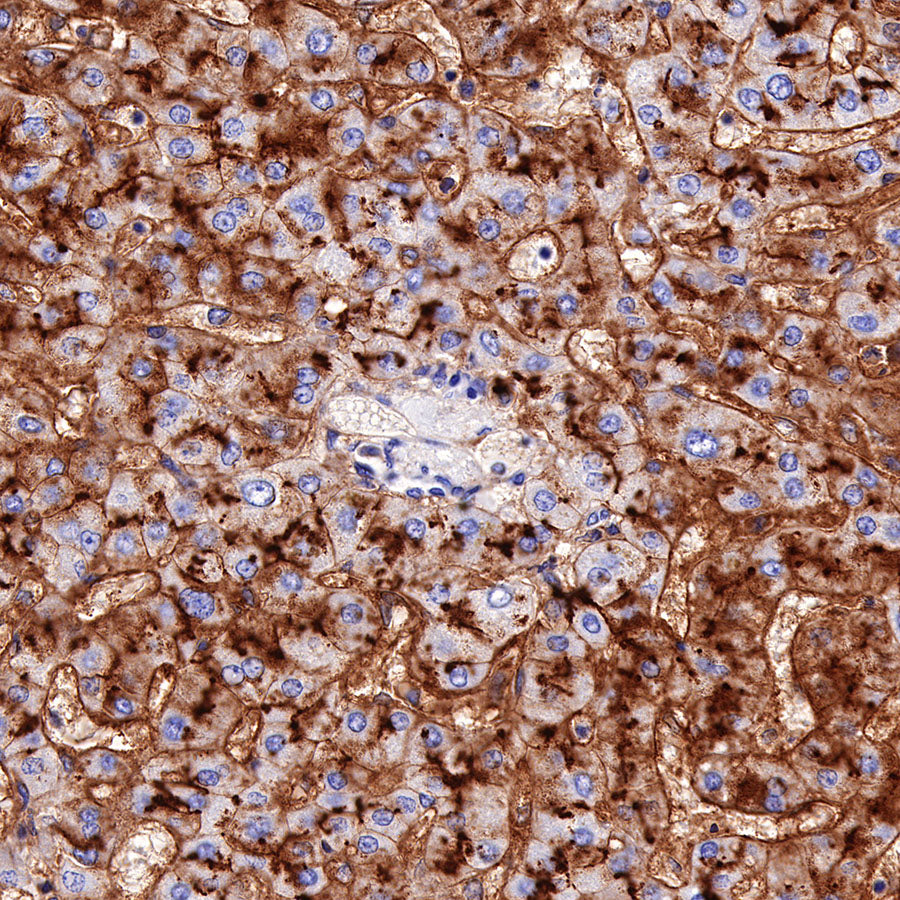 CD13 Recombinant Rabbit mAb (SDT-R162)