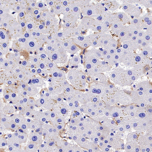 TIM-3 Recombinant Rabbit mAb (S-1450-21)