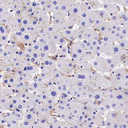 TIM-3 Recombinant Rabbit mAb (S-1450-21)