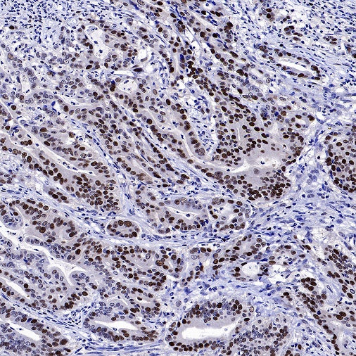 Phospho-NAK/TBK1 (Ser172) Recombinant Rabbit mAb (S-3182)