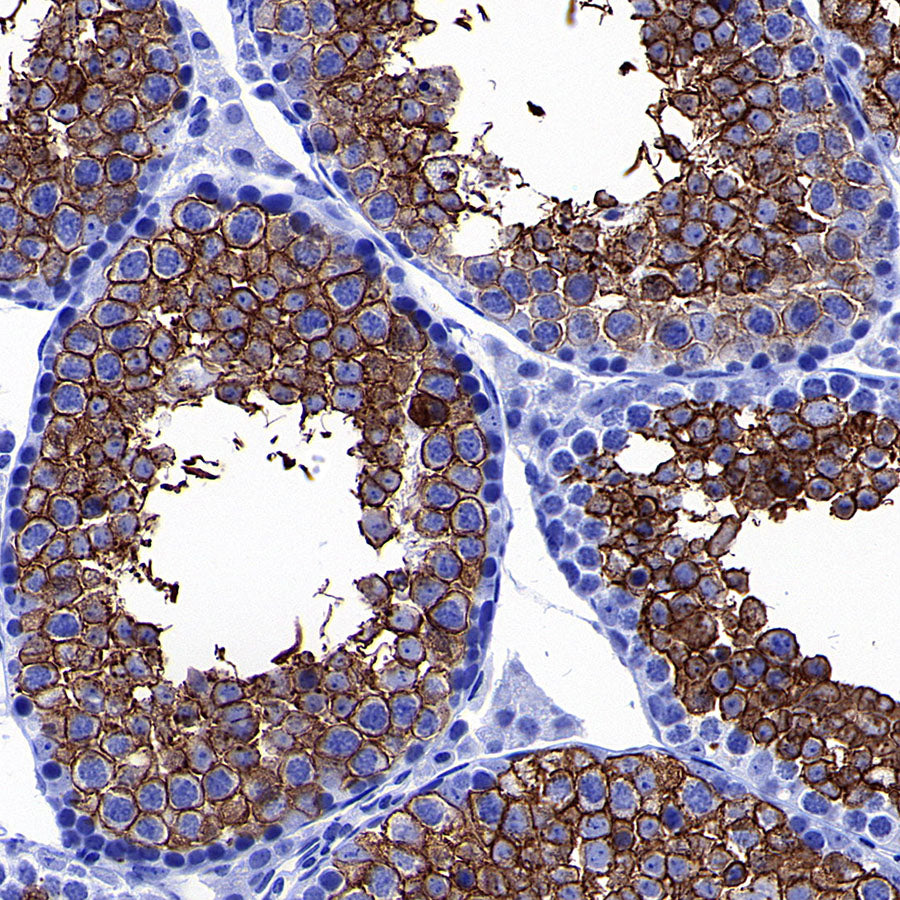 GLUT3 + GLUT14 Recombinant Rabbit mAb (S-5945)