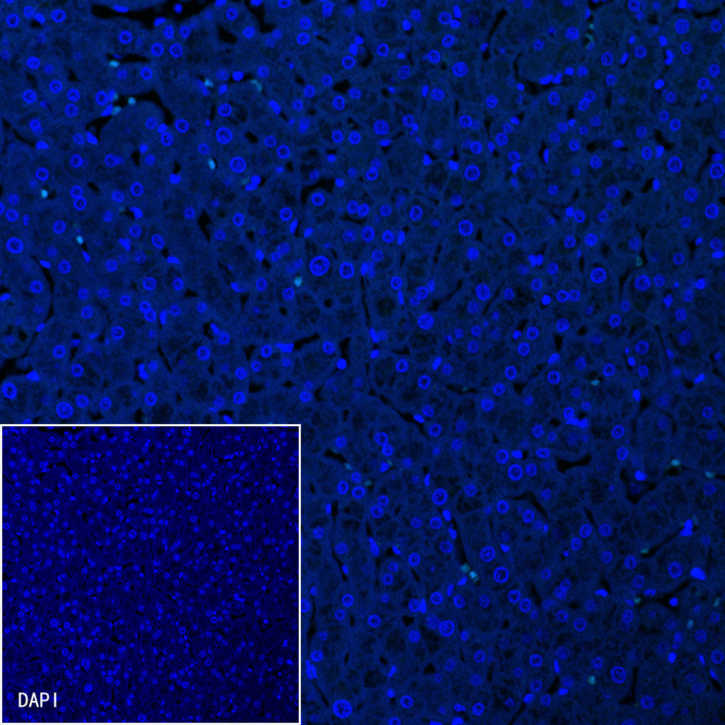 Somatostatin Recombinant Rabbit mAb (S-1103-79)