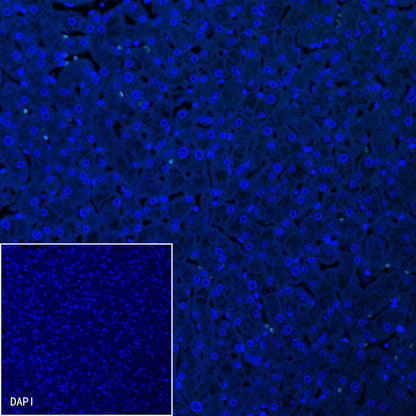 Somatostatin Recombinant Rabbit mAb (S-1103-79)