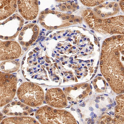 AMPK α1 Rabbit Polyclonal Antibody