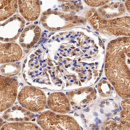 AMPK α1 Rabbit Polyclonal Antibody