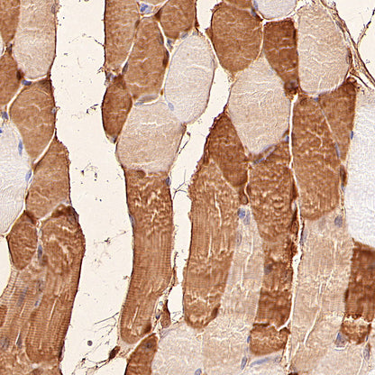 Myoglobin Recombinant Rabbit mAb (S-6197)