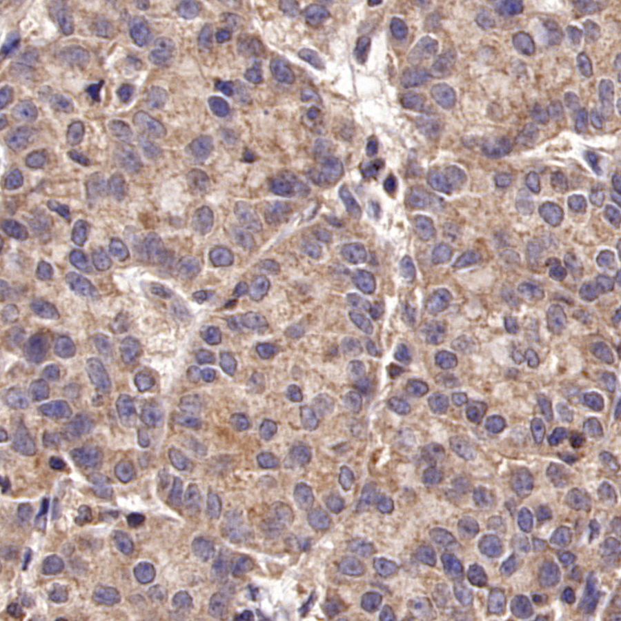 TYK2 Recombinant Rabbit mAb (S-2740-165)