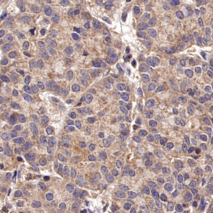 TYK2 Recombinant Rabbit mAb (S-2740-165)
