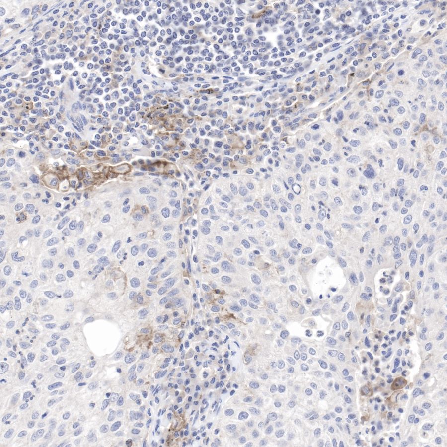 S-RMab® PD-L1 Recombinant Rabbit mAb (SDT-119-16)