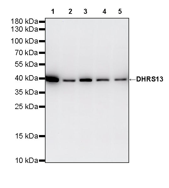 DHRS13 Recombinant Rabbit mAb (S-4011-7)