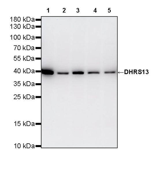 DHRS13 Recombinant Rabbit mAb (S-4011-7)