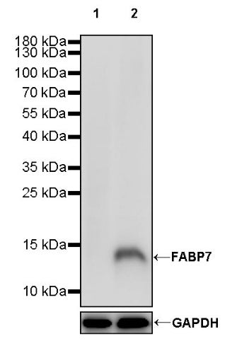 FABP7 Recombinant Rabbit mAb (S-762-114)