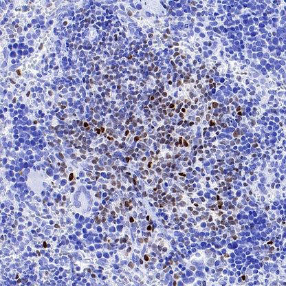 Runx2 Recombinant Rabbit mAb (S-1767-173)