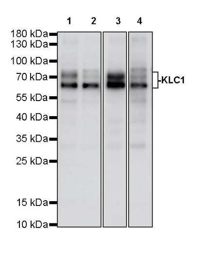 KLC1 Recombinant Rabbit mAb (S-4556-17)
