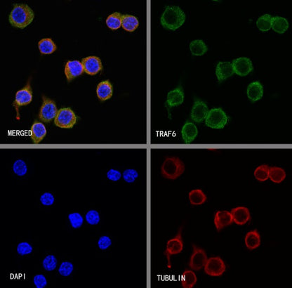 TRAF6 Recombinant Rabbit mAb (S-1087-44)