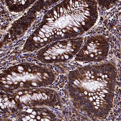 YB1 Recombinant Rabbit mAb (S-1748-144)