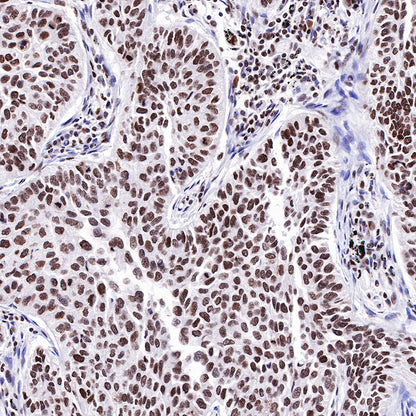 HDAC1 Recombinant Rabbit mAb (SDT-310-72)