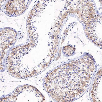 Amyloid Precursor Protein Recombinant Rabbit mAb (S-806-13)