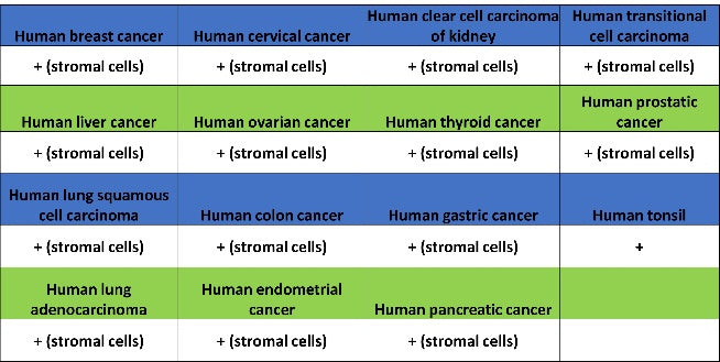 TAGLN/Transgelin Recombinant Rabbit mAb (S-1715-59)