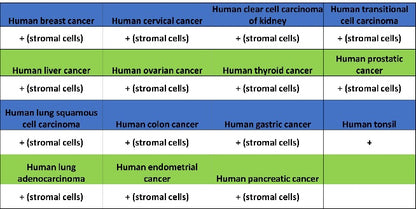 TAGLN/Transgelin Recombinant Rabbit mAb (S-1715-59)
